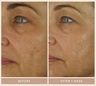 Shani Darden Retinol Reform with 1% Encapsulated Retinol 10 ml