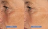 Dr. Barbara Sturm The Peptide Serum 30 ml