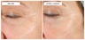 111Skin Repair Serum NAC Y2
