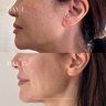 THE SKINCARE TOOLS 4D Pro Laser Light Therapy Face Mask