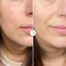Pai Skincare Partners in Calm Cleanser & Moisturizer Set