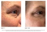 THE SKINCARE TOOLS 4D Pro Laser Light Therapy Face Mask