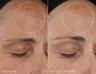 Medik8 Retinal Recharge