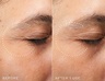 Medik8 Retinal Recharge