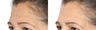 Perricone MD Neuropeptide Deep Crease Serum