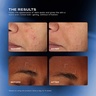 The Outset Total Clarity Dark Spot Serum