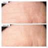 111Skin Exosome At-Home Face Lift Protocol