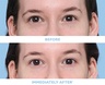 Peter Thomas Roth TOTAL EYE RESET 4-PAIR SET