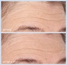 Perricone MD Cold Plasma Plus+ Advanced Hydrating Complex