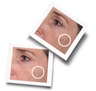 Murad Rapid Dark Spot Correcting Serum 30ml