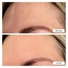 111Skin Dark Spot Correcting Serum