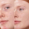 PURE U Refill Concealer Balm Nr. 4