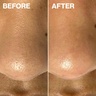 Dermaflash DERMAPORE Sea Foam