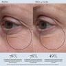 Dr. Loretta Tightening Eye Gel