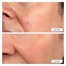 111Skin Dark Spot Correcting Serum