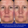 Augustinus Bader The Hydrogel Face Mask 6 Stück