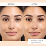 Patchology Skin Remedy Calm & Protect Mist