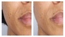 U Beauty Resurfacing Flash Peel