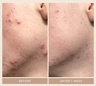 Shani Darden Rescue Serum with 10% Azelaic Complex