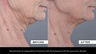 Zelens Collagen Solution Firming Serum for Face and Neck 30ml