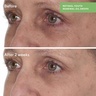 Murad Retinol Youth Renewal Oil Drops