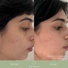 Kat Burki VITABIOME™ ACTIVE SKIN OPTIMIZER 100ml
