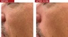 Dr. Levy Switzerland The Contour Pro