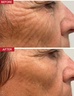 Dr. Levy Switzerland The Contour Pro